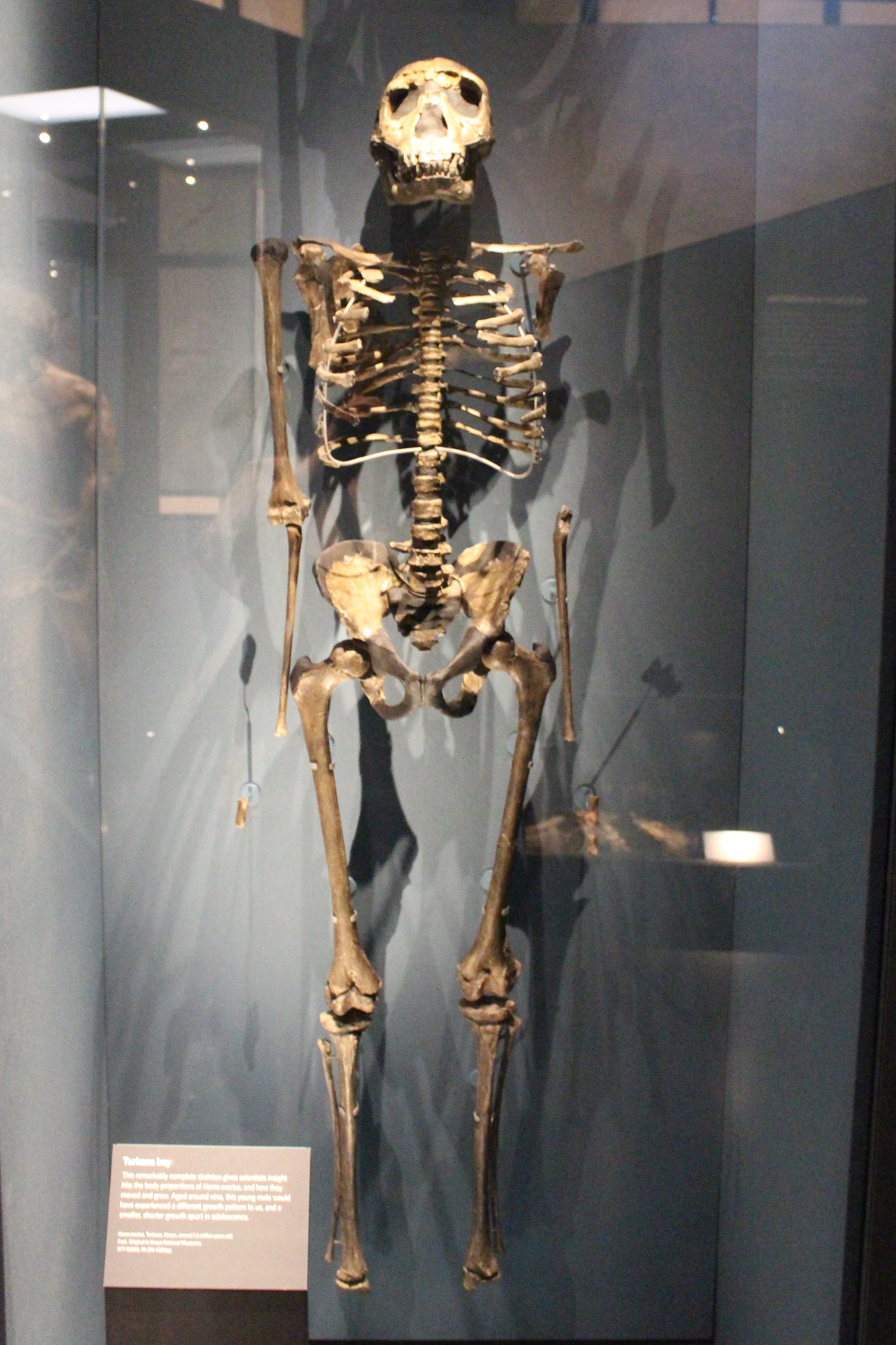 Homo erectus KNM WT 15000 skeleton.