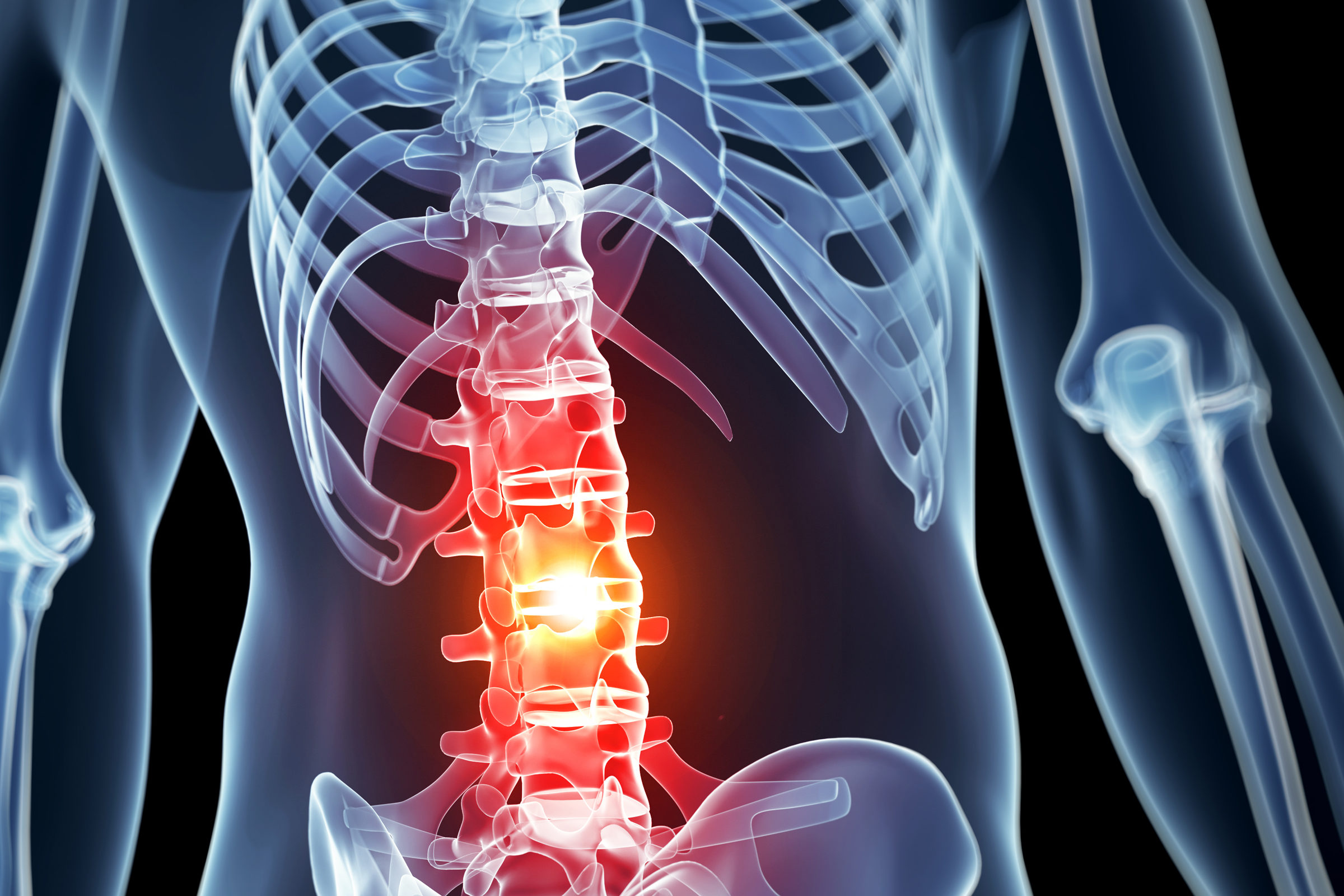 Image result for spinal cord injury